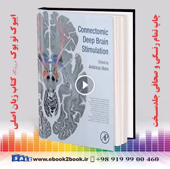 Connectomic Deep Brain Stimulation