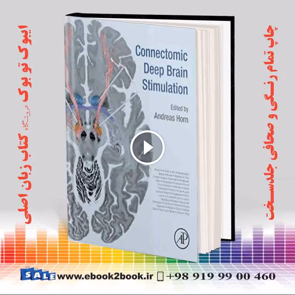 Connectomic Deep Brain Stimulation