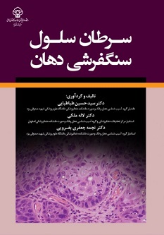 سرطان سلول سنگفرشی دهان