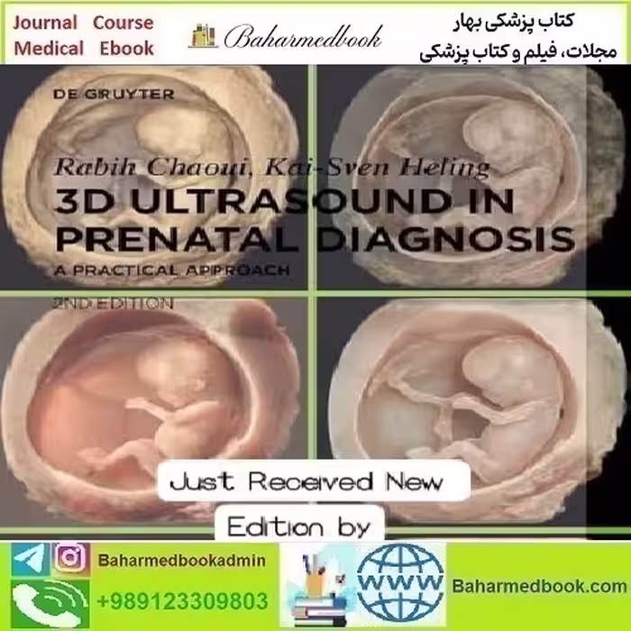 3D Ultrasound in prenatal diagnosis by Rabih Chaoui 2nd edit
