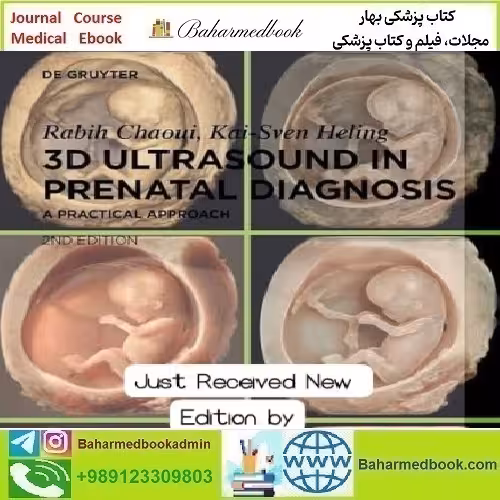 3D Ultrasound in prenatal diagnosis by Rabih Chaoui 2nd edit