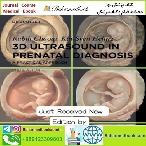 3D Ultrasound in prenatal diagnosis by Rabih Chaoui 2nd edit