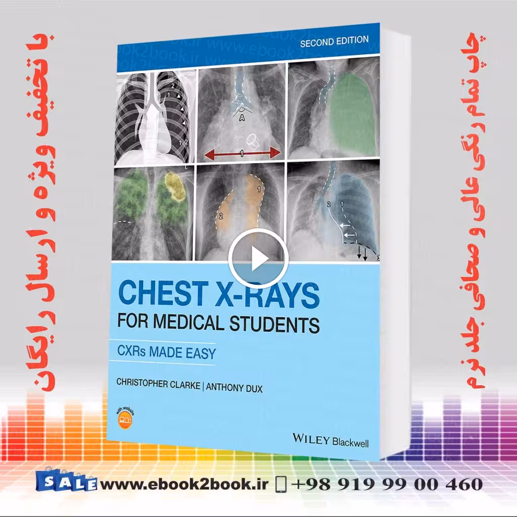Chest X-Rays for Medical Students