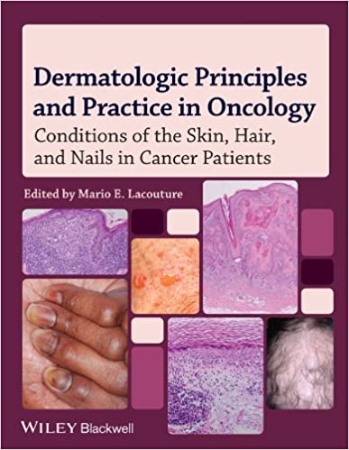 Dermatologic Principles and Practice in Oncology: Conditions of the Skin, Hair, and Nails in Cancer Patients, 1ed - کتاب پزشکی بهار