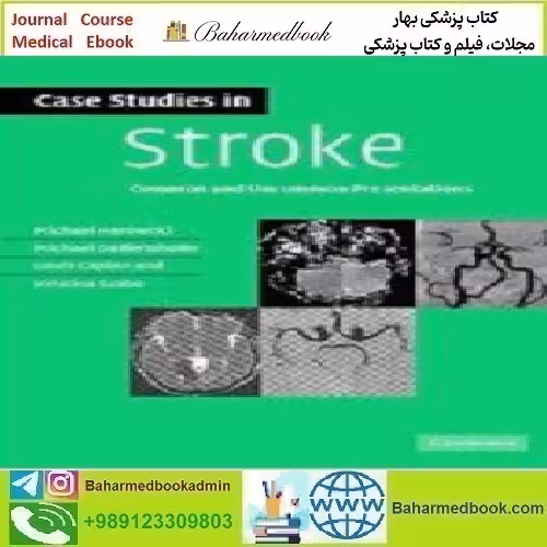 Case Studies in Stroke Common and Uncommon Presentations
