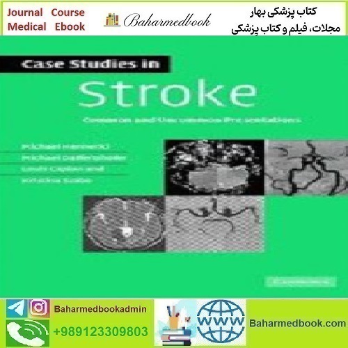 Case Studies in Stroke Common and Uncommon Presentations