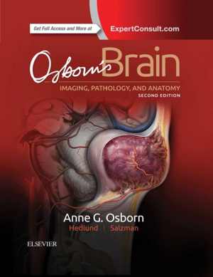 [PDF] دانلود کتاب Osborn’S Brain - Imaging, Pathology, And Anatomy, 2nd ed, 2018