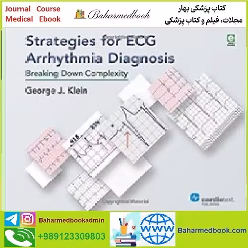 Strategies for ECG Arrhythmia Diagnosis Breaking Down Complex