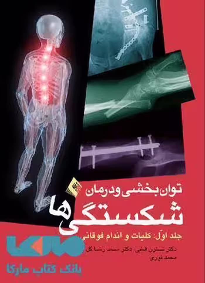 توان بخشی و درمان شکستگی ها جلد 1 (کلیات و اندام فوقانی) نشر ارجمند