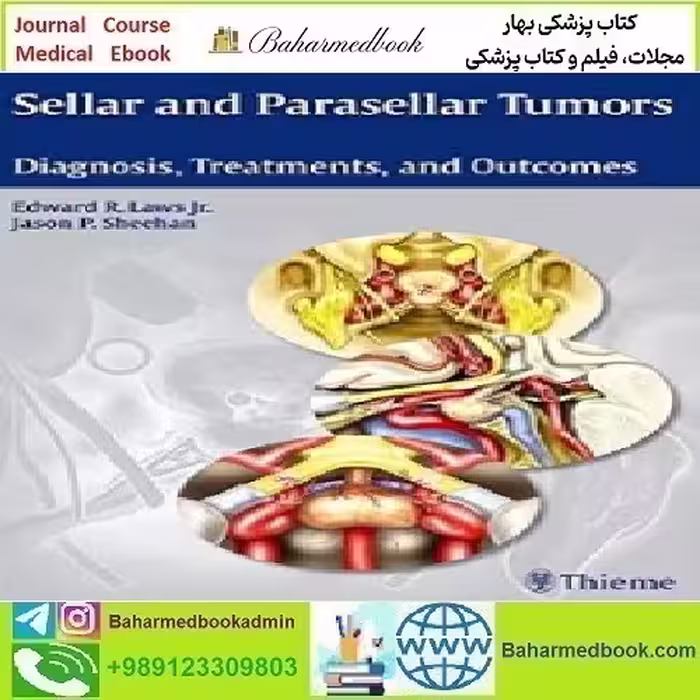 Sellar and Parasellar Tumors Diagnosis Treatments and Outcome