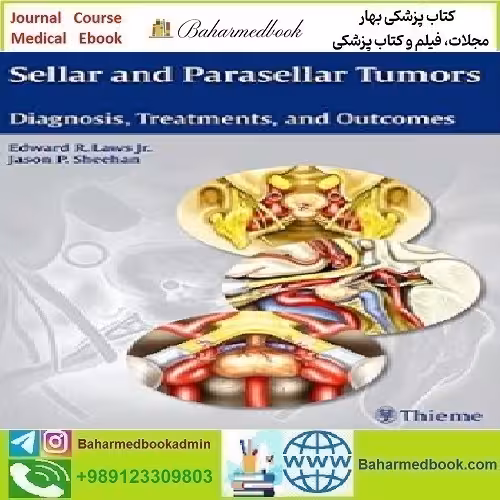 Sellar and Parasellar Tumors Diagnosis Treatments and Outcome