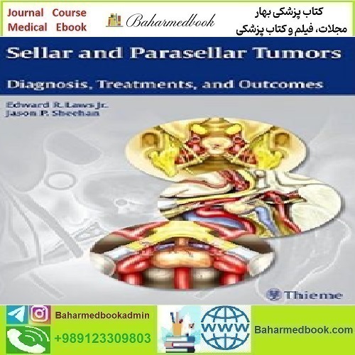 Sellar and Parasellar Tumors Diagnosis Treatments and Outcome