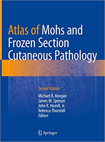  دانلود کتاب Atlas Of Mohs And Frozen Section Cutaneous Pathology, 2018 - دانلود کتاب های دانشگاهی