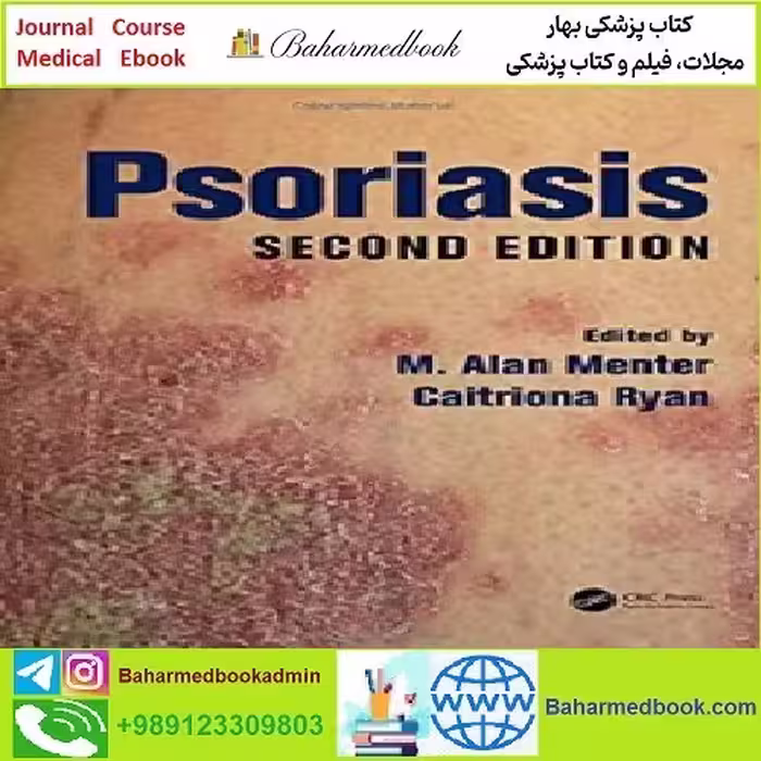 Psoriasis Second Edition TRUE PDF price 1€ - کتاب پزشکی بهار