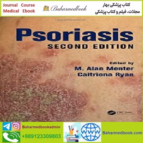 Psoriasis Second Edition TRUE PDF price 1€ - کتاب پزشکی بهار