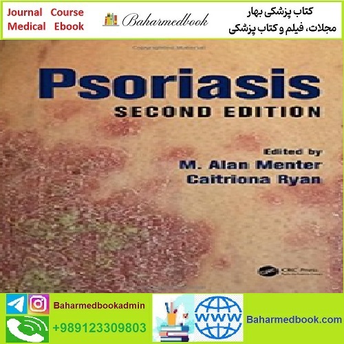 Psoriasis Second Edition TRUE PDF price 1€ - کتاب پزشکی بهار
