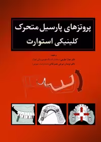پروتزهای پارسیل متحرک کلینیکی استوارت