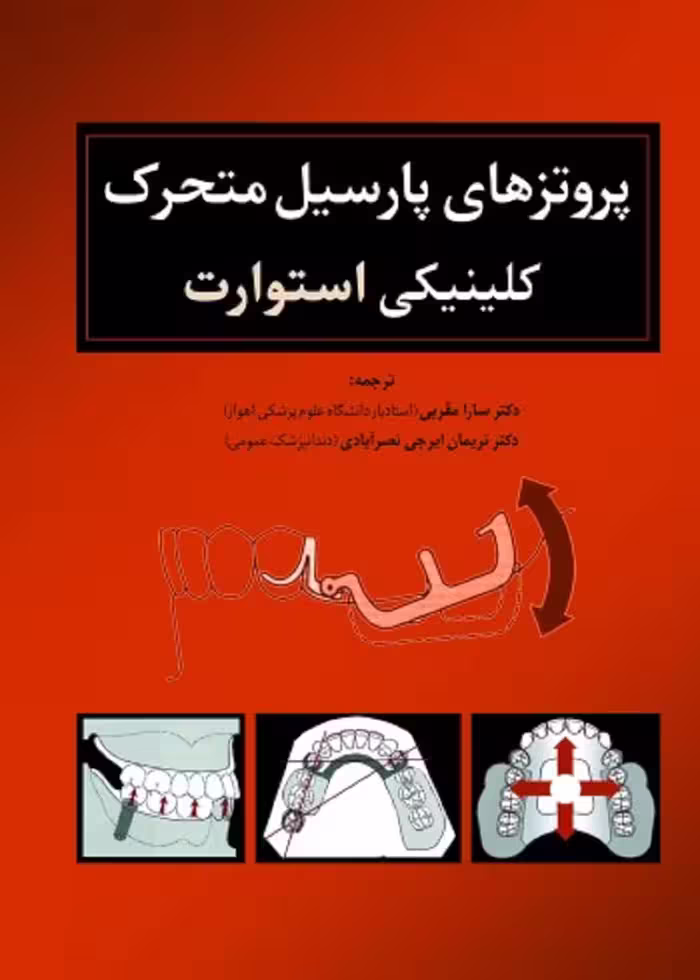 پروتزهای پارسیل متحرک کلینیکی استوارت