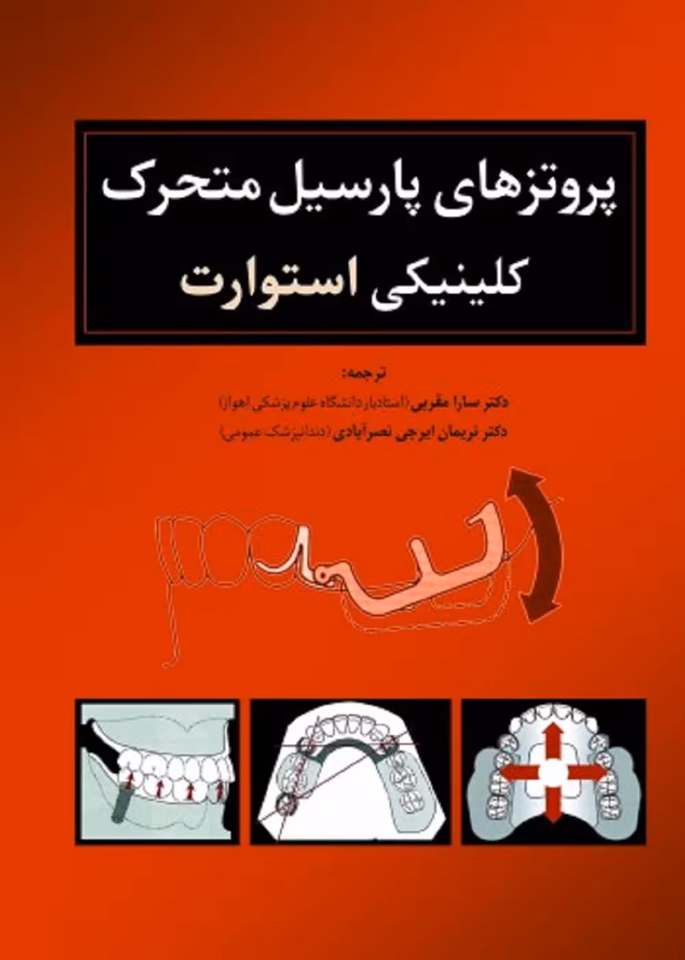 پروتزهای پارسیل متحرک کلینیکی استوارت