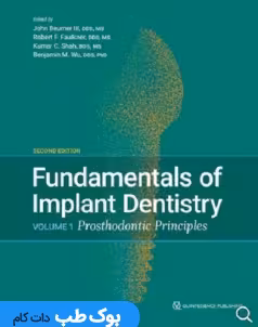 Fundamentals of Implant Dentistry 2022 : Prosthodontic Principles Vol 1