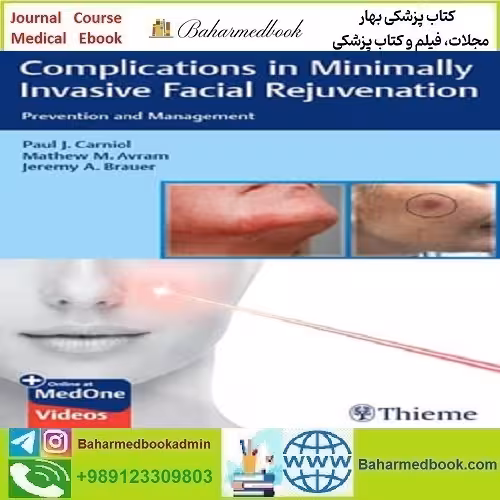 Complications in Minimally Invasive Facial دانلود فیلم و ایبوک