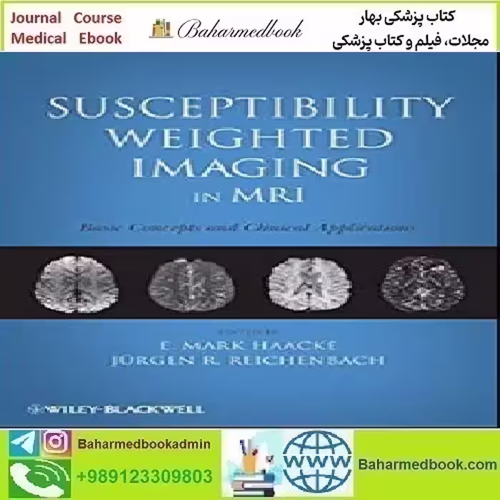 Susceptibility Weighted Imaging in MRI 2011 TRUE PDF price 1€ - کتاب پزشکی بهار