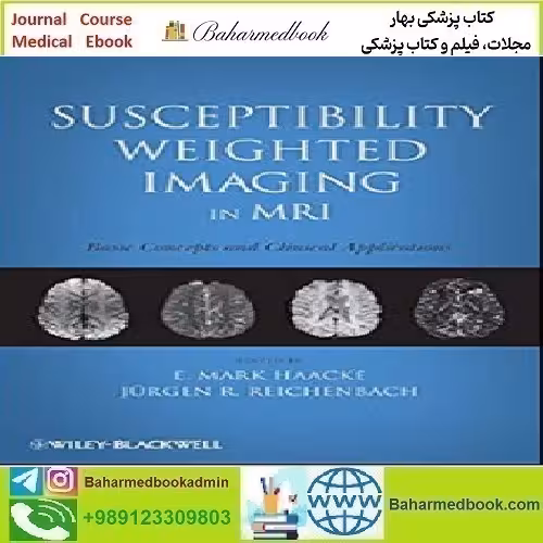 Susceptibility Weighted Imaging in MRI 2011 TRUE PDF price 1€ - کتاب پزشکی بهار