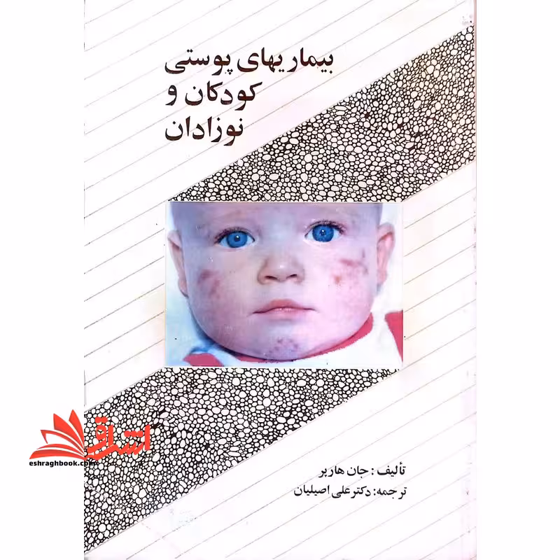 بیماری های پوستی کودکان و نوزادان - فروشگاه کتاب اشراق