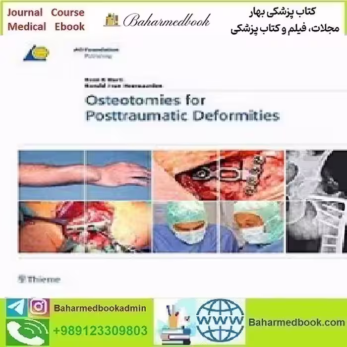 Osteotomies for Posttraumatic Deformities 2009 TRUE PDF pric