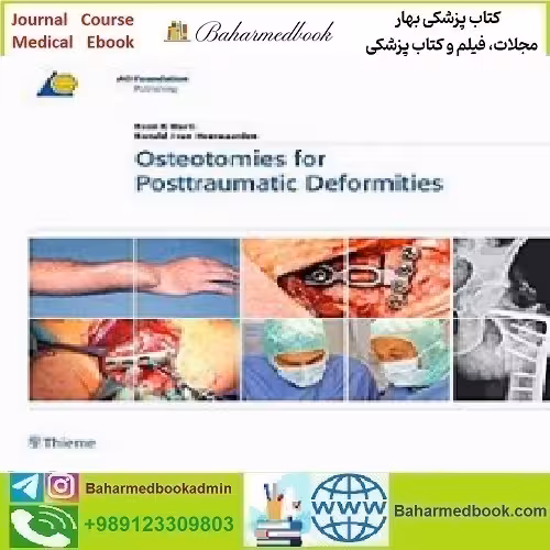 Osteotomies for Posttraumatic Deformities 2009 TRUE PDF pric