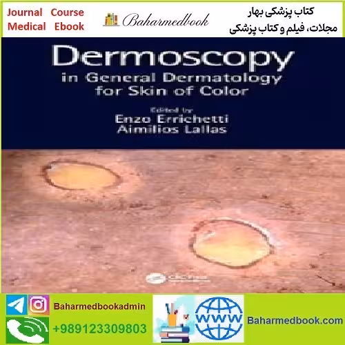Dermoscopy in General Dermatology for Skin of Color TRUE PD