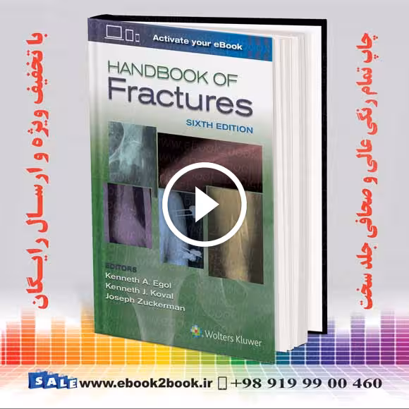 Handbook of Fractures 6th Edition