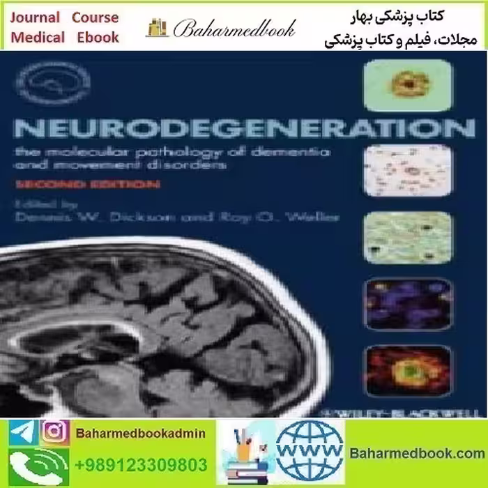 Neurodegeneration The Molecular Pathology of Dementia and M