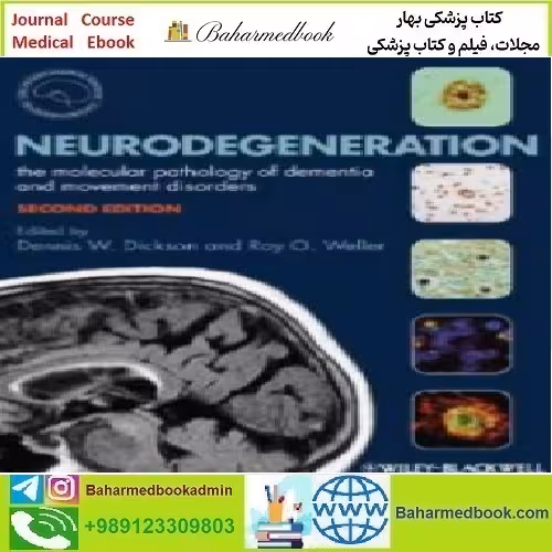Neurodegeneration The Molecular Pathology of Dementia and M