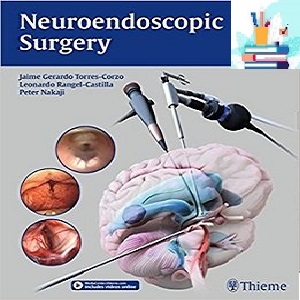 Neuroendoscopic Surgery 1ed PDF Video at 2€ - کتاب پزشکی بهار