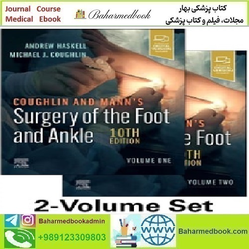 Coughlin and Mann’s Surgery of the Foot and Ankle 2024 T