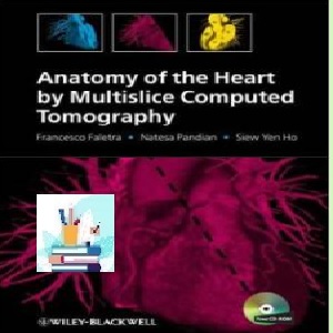 Anatomy of the Heart by Multislice Computed Tomography TRUE