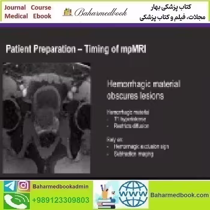 Prostate MR Case Review 2024 video course price 60€ - کتاب پزشکی بهار