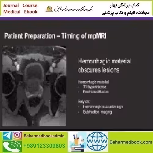 Prostate MR Case Review 2024 video course price 60€ - کتاب پزشکی بهار