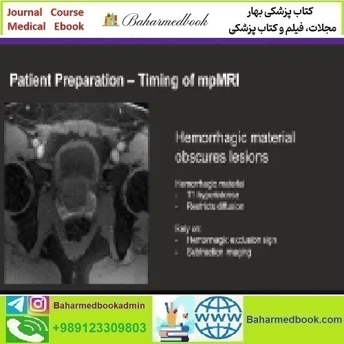 Prostate MR Case Review 2024 video course price 60€ - کتاب پزشکی بهار