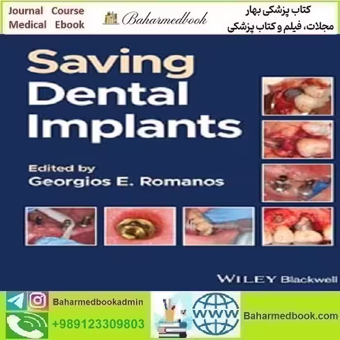 Saving Dental Implants 2024 TRUE PDF price 1€ دانلود کتاب الکترونیکی - کتاب پزشکی بهار
