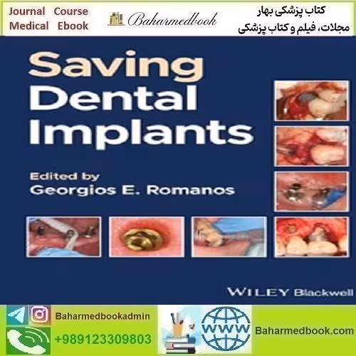 Saving Dental Implants 2024 TRUE PDF price 1€ دانلود کتاب الکترونیکی - کتاب پزشکی بهار