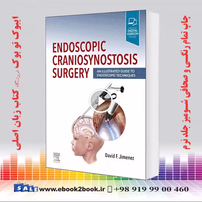 Endoscopic Craniosynostosis Surgery