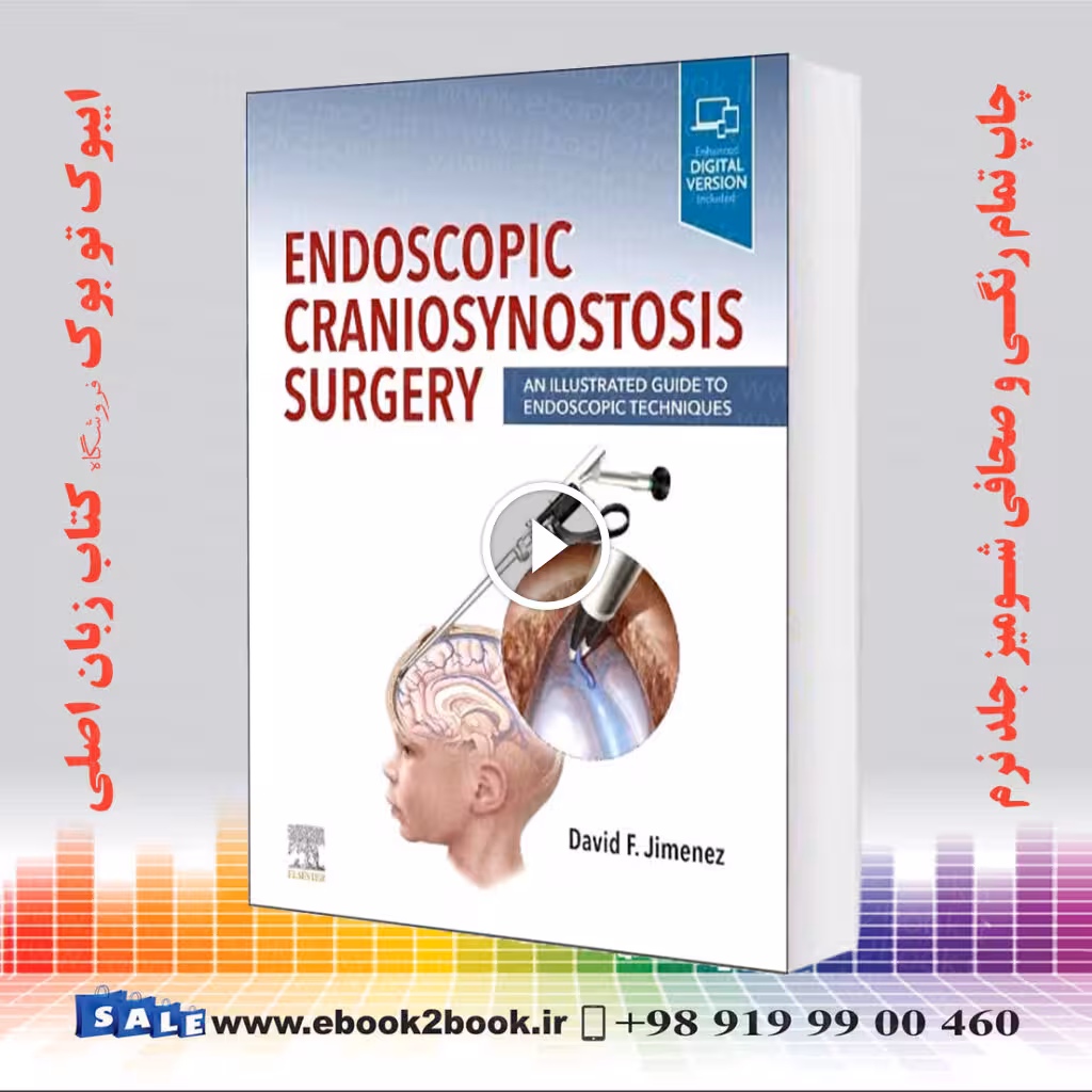 Endoscopic Craniosynostosis Surgery
