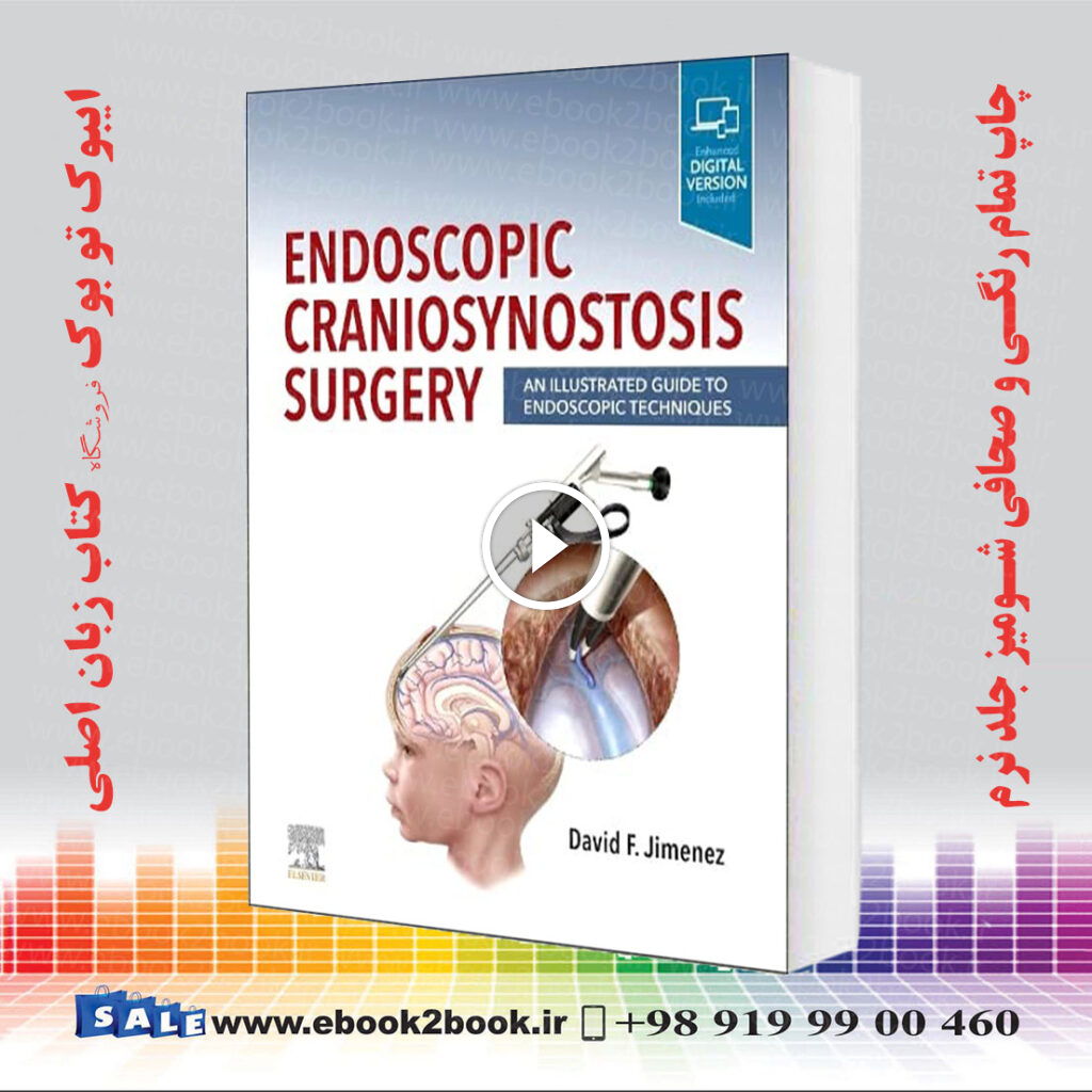 Endoscopic Craniosynostosis Surgery