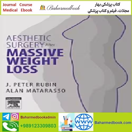 Aesthetic Surgery After Massive Weight Loss TRUE PDF price 1€