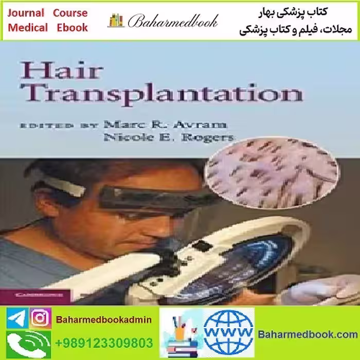 Hair Transplantation TRUE PDF price 1€
