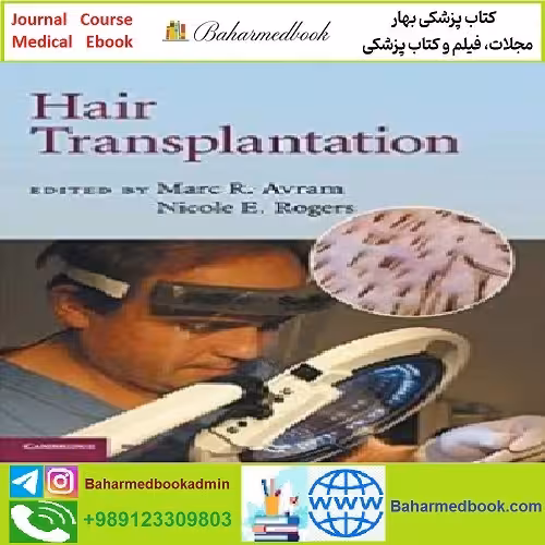 Hair Transplantation TRUE PDF price 1€