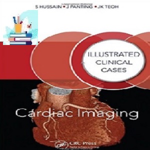 Cardiac Imaging TRUE PDF price 1€