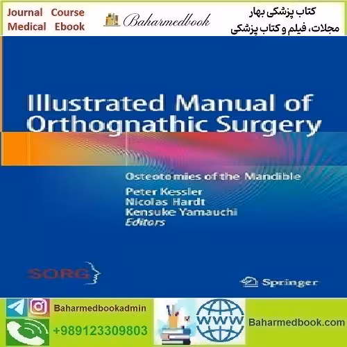 Illustrated Manual of Orthognathic Surgery Osteotomies of